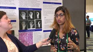 Dr Sheetal Patel at RWCS 2018 Poster Presentation [upl. by Eniahs]