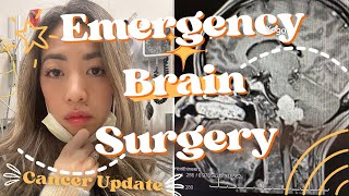 Cancer Growing in my Skull  Need Emergency Craniotomy [upl. by Secnirp]