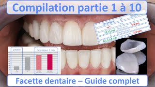 Facette dentaire  Guide complet  Compilation partie 1 à 10 [upl. by Oninrutas308]