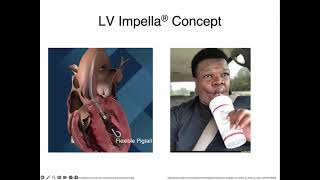 Impella What the Intensivist Needs to Know  Part 1 [upl. by Avat]