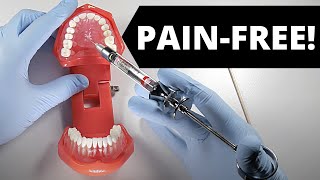 Deliver A Painless Palatal Injection  OnlineExodontiacom [upl. by Liw667]