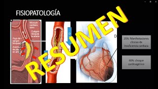 INFARTO AGUDO AL MIOCARDIO IAM FISIOPATOLOGIA [upl. by Husch]