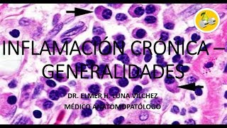 INFLAMACIÓN CRÓNICA – GENERALIDADES  Dr Elmer Luna Vilchez [upl. by Ennairej749]