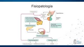 Fisiopatología Síndrome de Ovario Poliquístico [upl. by Chrysler]