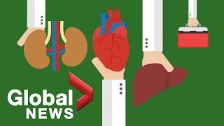 Why Canada struggles to perform just 600 organ donations per year [upl. by Joye87]