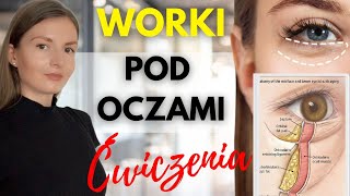 WORKI POD OCZAMI  jak zlikwidować [upl. by Sandberg]