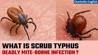 Scrub Typhus kills 5 in Odisha 9 in Shimla  Know about this deadly infection  Oneindia News [upl. by Ruthann]