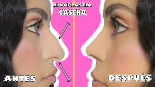 TRUCO PARA RINOPLASTIA CASERA EN 3 MINUTOS  sin cirugía cambio increíble [upl. by Quar]