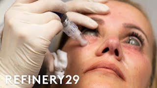 The Truth About This Controversial Injection Trend  Shady  Refinery29 [upl. by Immac]