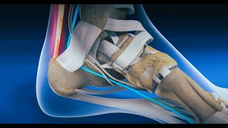 Endoscopic FHL Transfer for Achilles Tendon Ruptures [upl. by Luy]