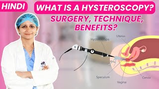 What Is a Hysteroscopy  Surgery Technique Benefits Hindi  Dr Jyoti Gynecologist [upl. by Salchunas]