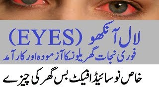 Ankho Ki Surkhi or LAL Pan Ka Ilaj  Infection eyes Redness in eyes Home Remedies for eye pain [upl. by Gibbon]