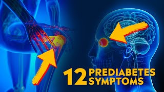 12 Warning Signs of Prediabetes What You Need to Know [upl. by Adon]