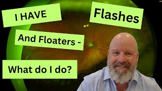 The Shocking Truth About Flashes and Floaters [upl. by Niatsirt]