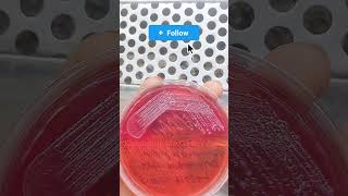 klebsiella in MacConkey Agar। microscope microbiology bacteria youbtube science [upl. by Thury881]