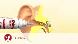 How to get rid of earwax and remove ear wax at home [upl. by Ileak]