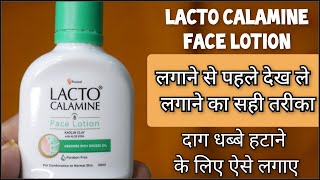 लैक्टो कैलामाइन लोशन Lacto Calamine Face Lotion  Review in hindi How to use lacto calamine lotion [upl. by Hoffmann84]