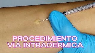 🔴DEMOSTRACIÓN 💉 VIA INTRADERMICA Administración de medicamentos Cofia Educativa [upl. by Dnumsed]