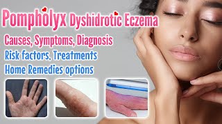 Pompholyx overview causes signs symptoms treatment option and home remedies  Dyshidrotic eczema [upl. by Enyahc]