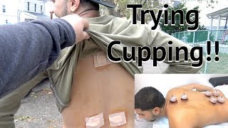 FIRST TIME TRYING CUPPING crazy experience  Yousif Saleh [upl. by Pease]