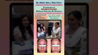 pigmentation blemishes melasma skincare [upl. by Albertina]