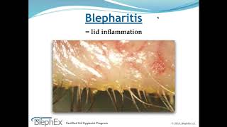 Dry Eye Decoded Webinar [upl. by Ahsrat12]