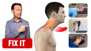 Correct Forward Head Posture with 3 Things  Dr Berg [upl. by Ardnod]