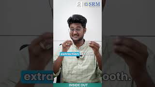 Dry Socket Dilemma  SRM Kattankulathur Dental College amp Hospital  SRMIST [upl. by Itra]