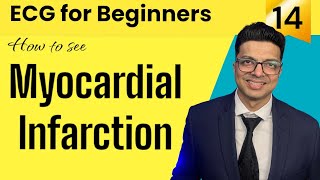 ECG for Beginners  How to see MYOCARDIAL INFARCTION in ECG  जानिए Evolution of MI in ECG [upl. by Anikal953]