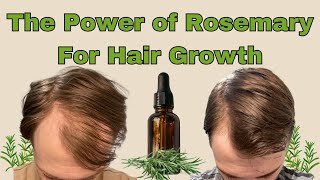 This Is How I Use Rosemary To Increase Hair Growth [upl. by Suhpesoj348]