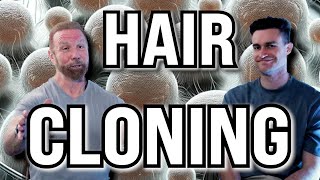 Hair Cloning Shocking Results ft Bobby Dunlap [upl. by Aleiram]