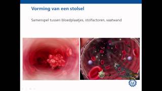 Hemostase deel 1 Inleiding  Prof dr REG Schutgens [upl. by Laidlaw]