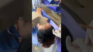 Hairfall Solution  PRP Session at DH doctor medicine docstory mbbs prp hairfall hairloss [upl. by Llet865]