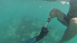 Snorkelling with Osseointegration implanted in Sydney Australia By the OGAAP team [upl. by Cecile]