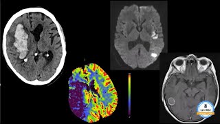 Lernrad Neuroradiologie Basics Kurs  Lust auf Fallbasiertes interaktives Lernen [upl. by Lurlene]