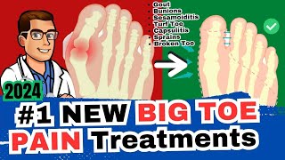 1 Big Toe Joint Pain Cure Arthritis Sesamoiditis Turf Toe Gout [upl. by Naujet829]