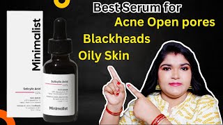 Minimalist Salicylic acid 2 serum Honest Review  How to use Salicylic acid serum in correct way [upl. by Poulter]