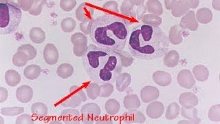 Understanding Leukograms in Veterinary Medicine [upl. by Itsirc]