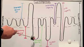 Do You Know the Spirogram [upl. by Dallman]