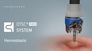 OTSC®neo  Hemostasis [upl. by Laumas174]