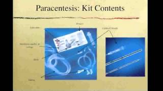 OSCE Paracentesis [upl. by Suirtemid]