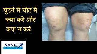 घुटने में चोट में क्या करे और क्या न करे  knee injury ya knee swelling me kin baato ka dhyan rakhe [upl. by Peer]