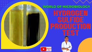 Hydrogen Sulfide Production Test Tamil  Biochemical Test  SIM Sulfide Indole MotilityMedium [upl. by Ecirtnas]