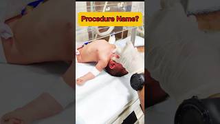 Procedure Name Human trachea ytshorts medical youtubeshorts nursing intubation hospital [upl. by Noyahs417]