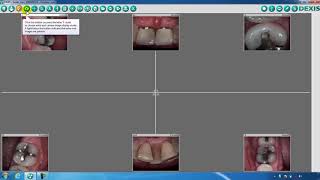 DEXIS™ Imaging Suite Toolbar Overview  Part One [upl. by Alleciram]