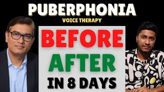 BeforeAfter Puberphonia Speech Therapy  Within 8 Days  SLPSanjayKumar  Speech Pathologist India [upl. by Ramahs]