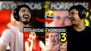 REACT 🔴 Plásticas Terríveis 3 As Plásticas que deram Totalmente Errado PARTE 3 FALA DE TUDO [upl. by Hurwitz]