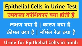 Epithelial Cells in Urine in hindi  Causes Symptoms Price amp Normal Range  उपकला कोशिकाएं क्या है [upl. by Soilissav]