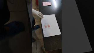 preparation of blood smearblood smearPBF smearyoutubeshorts health science labtechneetaims [upl. by Enybor461]