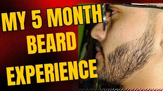 I Tried Minoxidil For A Beard  My 5 Month Journey [upl. by Budwig]